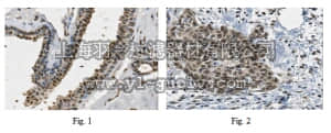 merck millipore,默克密理博,ABC331,Anti-PALB2 Antibody