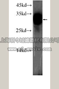 merck millipore,默克密理博,ABC373,Anti-HLA Antibody-DRB1