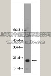 merck millipore,默克密理博,ABC377,Anti-RTN2 Antibody