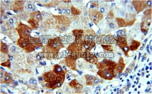 merck millipore,默克密理博,ABC382,Anti-H6PD Antibody