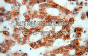 merck millipore,默克密理博,ABC396,Anti-CES1 Antibody merck millipore,默克密理博,ABC396,Anti-CES1 Antibody