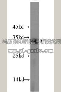 merck millipore,默克密理博,ABC400,Anti-SULT2A1 Antibody