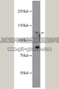 merck millipore,默克密理博,ABC418,Anti-PALB2 Antibody