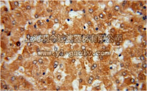 merck millipore,默克密理博,ABC420,Anti-CYP27A1 Antibody
