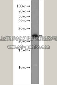 merck millipore,默克密理博,ABC423,Anti-RAB8A Antibody