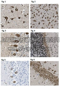 merck millipore,默克密理博,ABC443,Anti-LMO-3/Rhombotin-3 Antibody