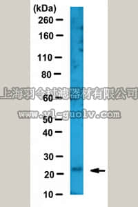 merck millipore,默克密理博,ABC458,Anti-Thymidylate Kinase/TMPK Antibody