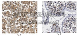 merck millipore,默克密理博,ABC468,Anti-MAGEA3 Antibody/MAGE3