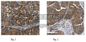 merck millipore,默克密理博,ABC499,Anti-Tropomyosin Antibody, isoforms 5a, 5b, Br2, Br3