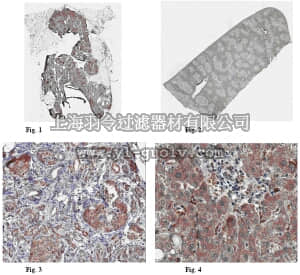merck millipore,默克密理博,ABC51,Anti-Kallistatin Antibody
