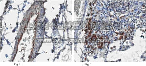 merck millipore,默克密理博,ABC60,Anti-Endostatin Antibody
