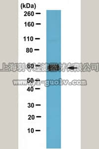 merck millipore,默克密理博,ABC74,Anti-IGPR-1 Antibody