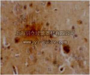 merck millipore,默克密理博,ABC830,Anti-SEC62 Antibody