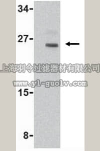 merck millipore,默克密理博,ABC845,Anti-Nop30 Antibody