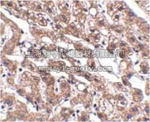 merck millipore,默克密理博,ABC851,Anti-MACC1 Antibody