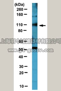 merck millipore,默克密理博,ABC89,Anti-Netrin receptor UNC5B Antibody