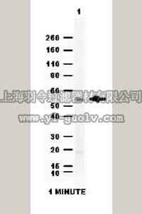 merck millipore,默克密理博,ABD12,Anti-Aldehyde dehydrogenase 1 (ALDH1A1) Antibody