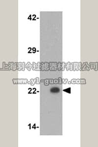 merck millipore,默克密理博,ABD132,Anti-PHOX2B Antibody