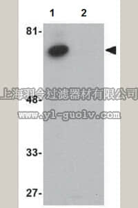 merck millipore,默克密理博,ABD133,Anti-ACVR1B Antibody