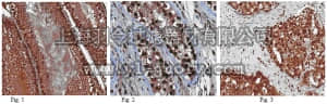 merck millipore,默克密理博,ABD31,Anti-DAZL Antibody