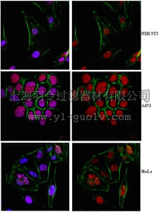 merck millipore,默克密理博,ABD41,Anti-Lymphoid-specific helicase (HELLS) Antibody