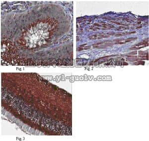 merck millipore,默克密理博,ABD66,Anti-Adipose Triglyceride Lipase (PNPLA2) Antibody