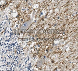 merck millipore,默克密理博,ABD80,Anti-CRTAC1 Antibody