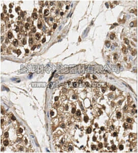 merck millipore,默克密理博,ABE1000,Anti-FOXM1 Antibody merck millipore,默克密理博,ABE1000,Anti-FOXM1 Antibody