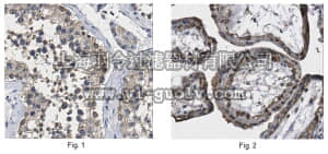 merck millipore,默克密理博,ABE1005,Anti-Cytosolic 5'-nucleotidase 1B Antibody