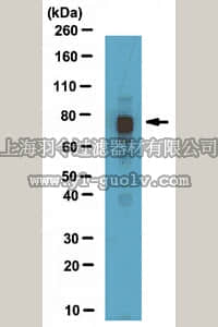 merck millipore,默克密理博,ABE171,Anti-MeCP2 Antibody