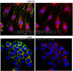 merck millipore,默克密理博,ABE208,Anti-β-Catenin Antibody