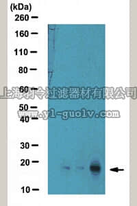 merck millipore,默克密理博,ABE289,Anti-trimethyl-Histone H3 (Lys18) Antibody