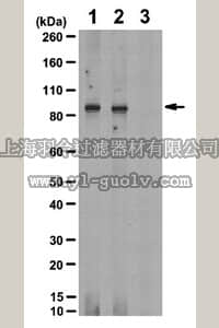 merck millipore,默克密理博,ABE332,Anti-phospho-IGF-1R (Tyr1161/Tyr1165/Tyr1166) Antibody