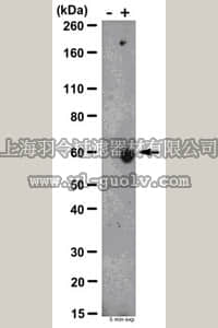 merck millipore,默克密理博,ABE33,Anti-phospho-Chk2 (Thr68) Antibody