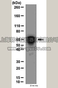 merck millipore,默克密理博,ABE347,Anti-NFκB p65 Antibody, CT