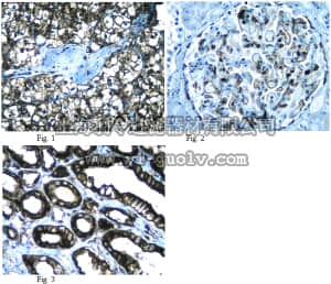 merck millipore,默克密理博,ABE38,Anti-HEN1 methyltransferase homolog 1 Antibody