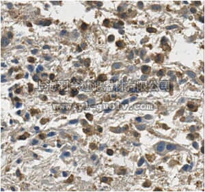 merck millipore,默克密理博,ABE454,Anti-IDH Antibody