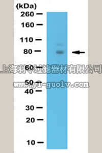 merck millipore,默克密理博,ABE471,Anti-WAC Antibody, CT