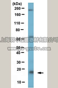 merck millipore,默克密理博,ABE480,Anti-Centrin-2 Antibody