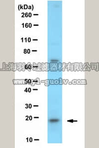 merck millipore,默克密理博,ABE481,Anti-Centrin-3 Antibody