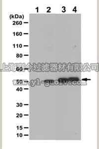 merck millipore,默克密理博,ABE501,Anti-phospho IRF3 (ser386) Antibody