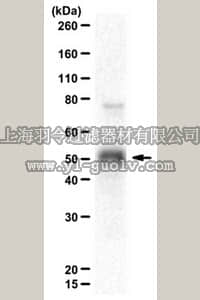 merck millipore,默克密理博,ABE530,Anti-Histone-lysine N-methyltransferase SUV39H2 Antibody