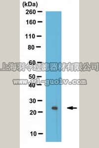merck millipore,默克密理博,ABE569,Anti-monoubiquitin H2A Antibody (Lys119)