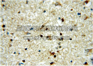 merck millipore,默克密理博,ABE581,Anti-HOXD13 Antibody