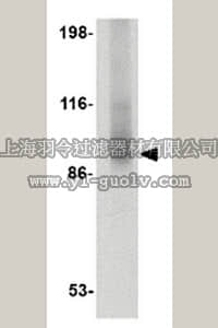 merck millipore,默克密理博,ABE599,Anti-TNPO3 Antibody