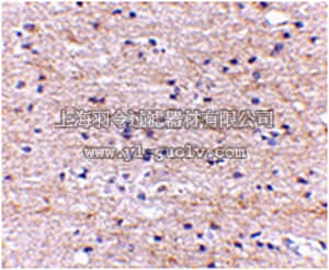 merck millipore,默克密理博,ABE600,Anti-SATB2 Antibody