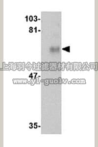 merck millipore,默克密理博,ABE601,Anti-CPEB1 Antibody