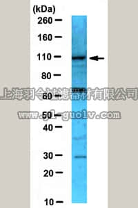 merck millipore,默克密理博,ABE62,Anti-MYSM1/2A-DUB Antibody