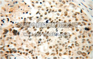 merck millipore,默克密理博,ABE635,Anti-ETV4 Antibody