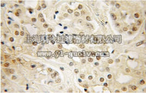 merck millipore,默克密理博,ABE670,Anti-LIN28 Antibody